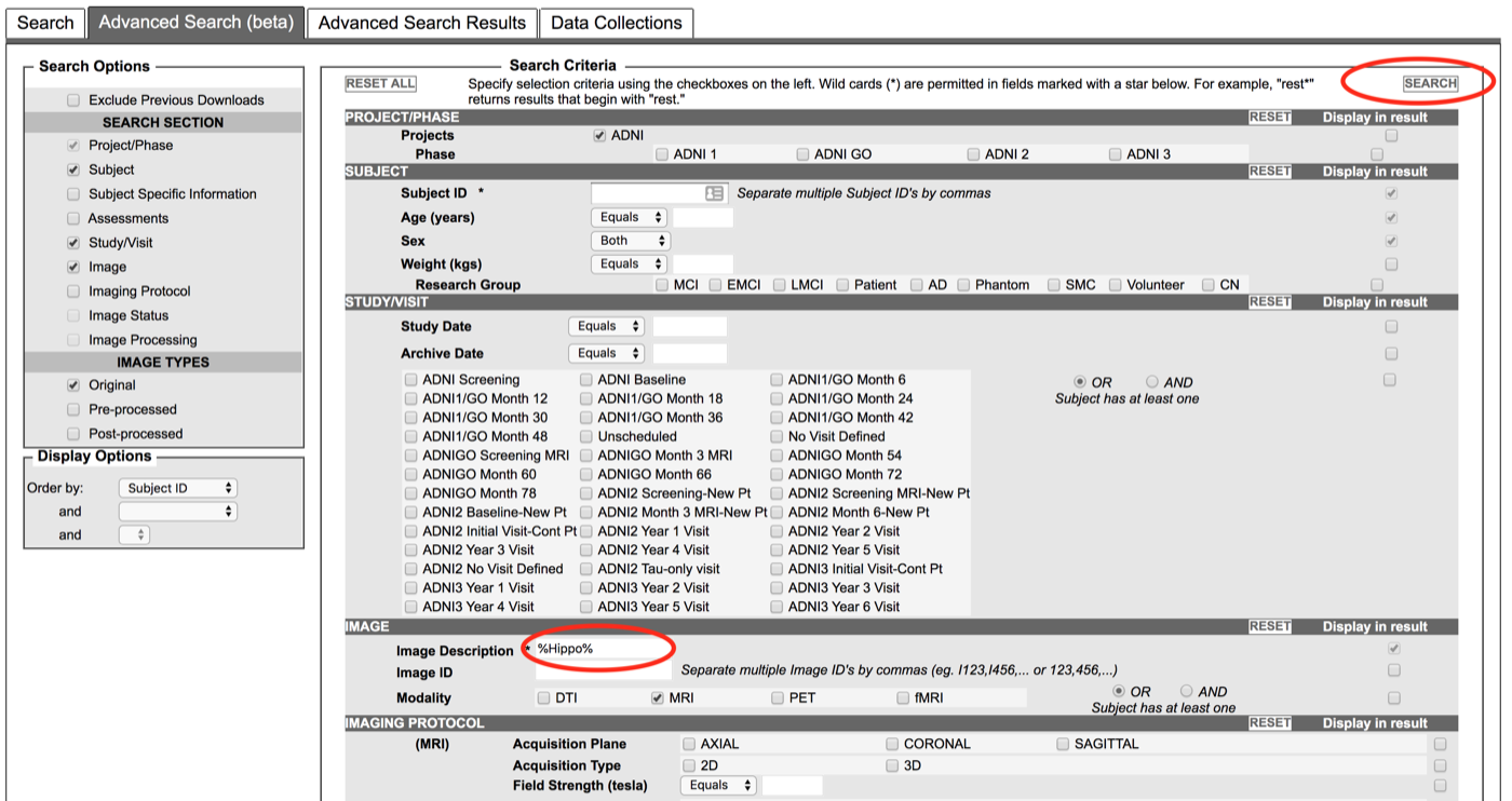 ADNI advanced search