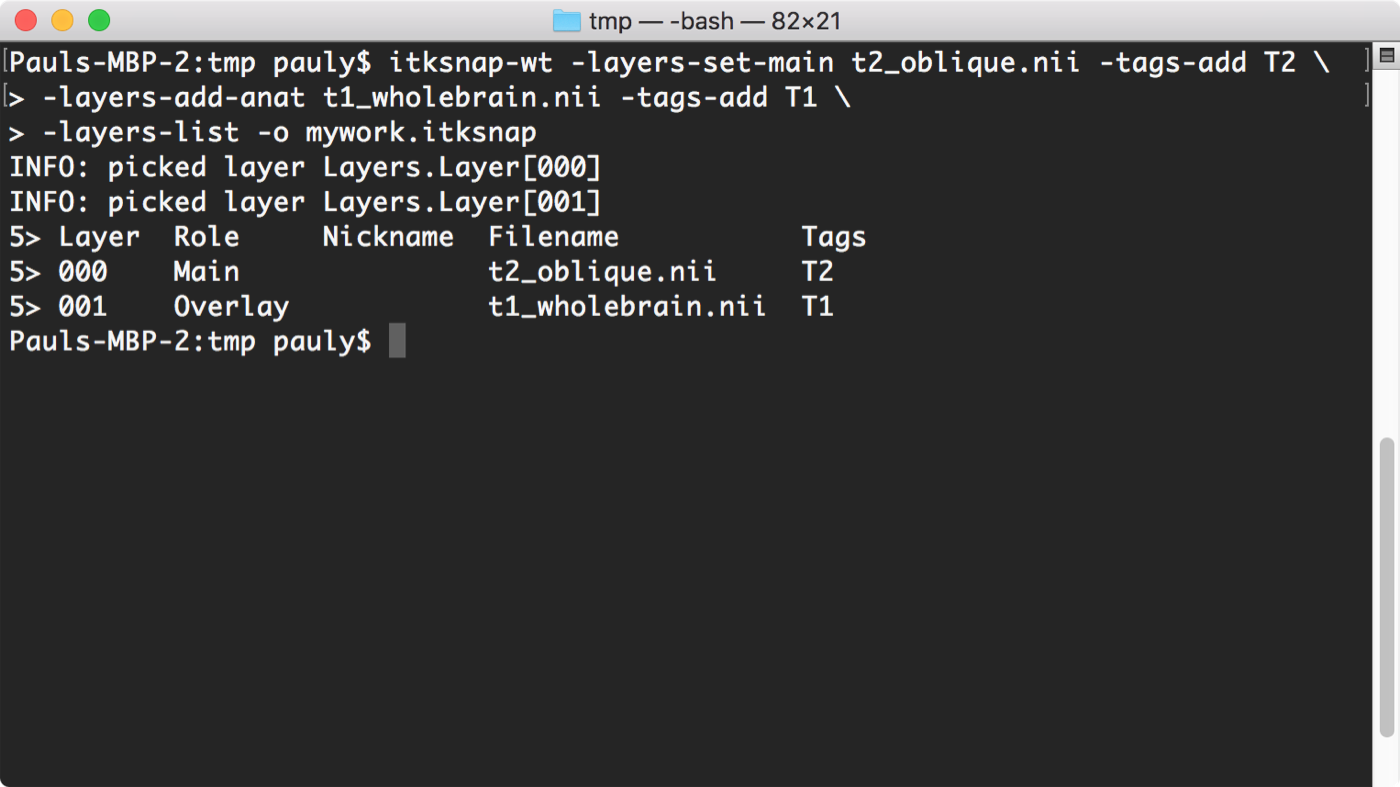 Creating a workspace with itksnap-wt