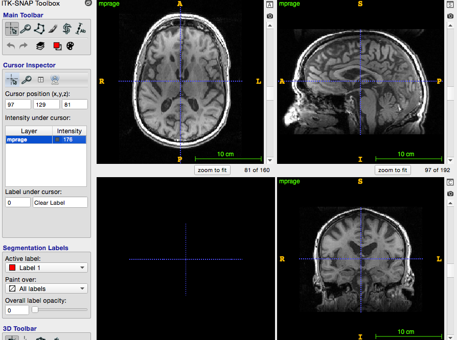 ITK-SNAP with a T1 image loaded