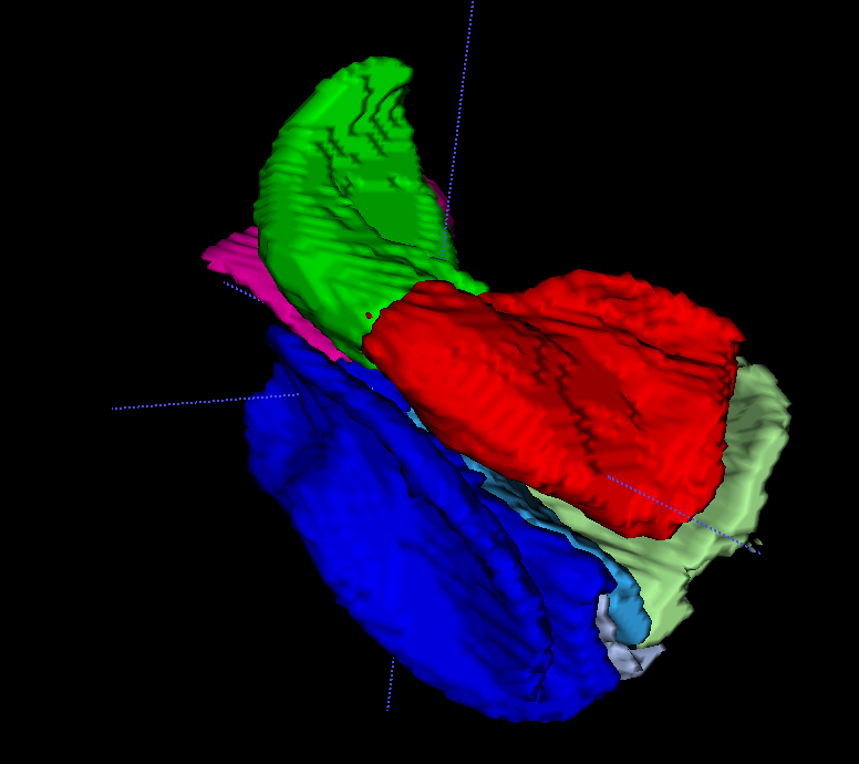 ASHS segmentation from T1-weighted MRI