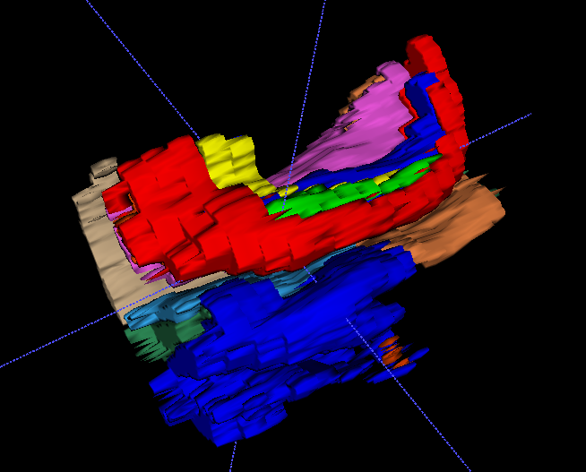 3D rendering of an ASHS Classic segmentation