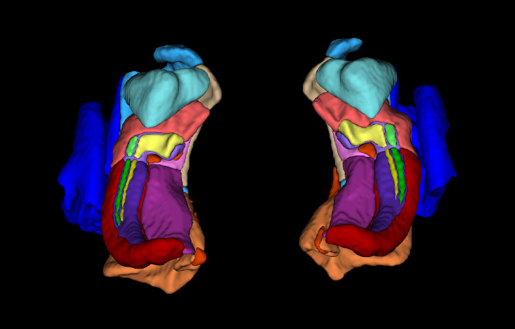3D rendering of a HyperASHS segmentation from T2w + T1w MRI