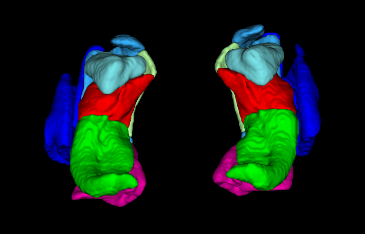 3D rendering of a HyperASHS segmentation from T1w MRI