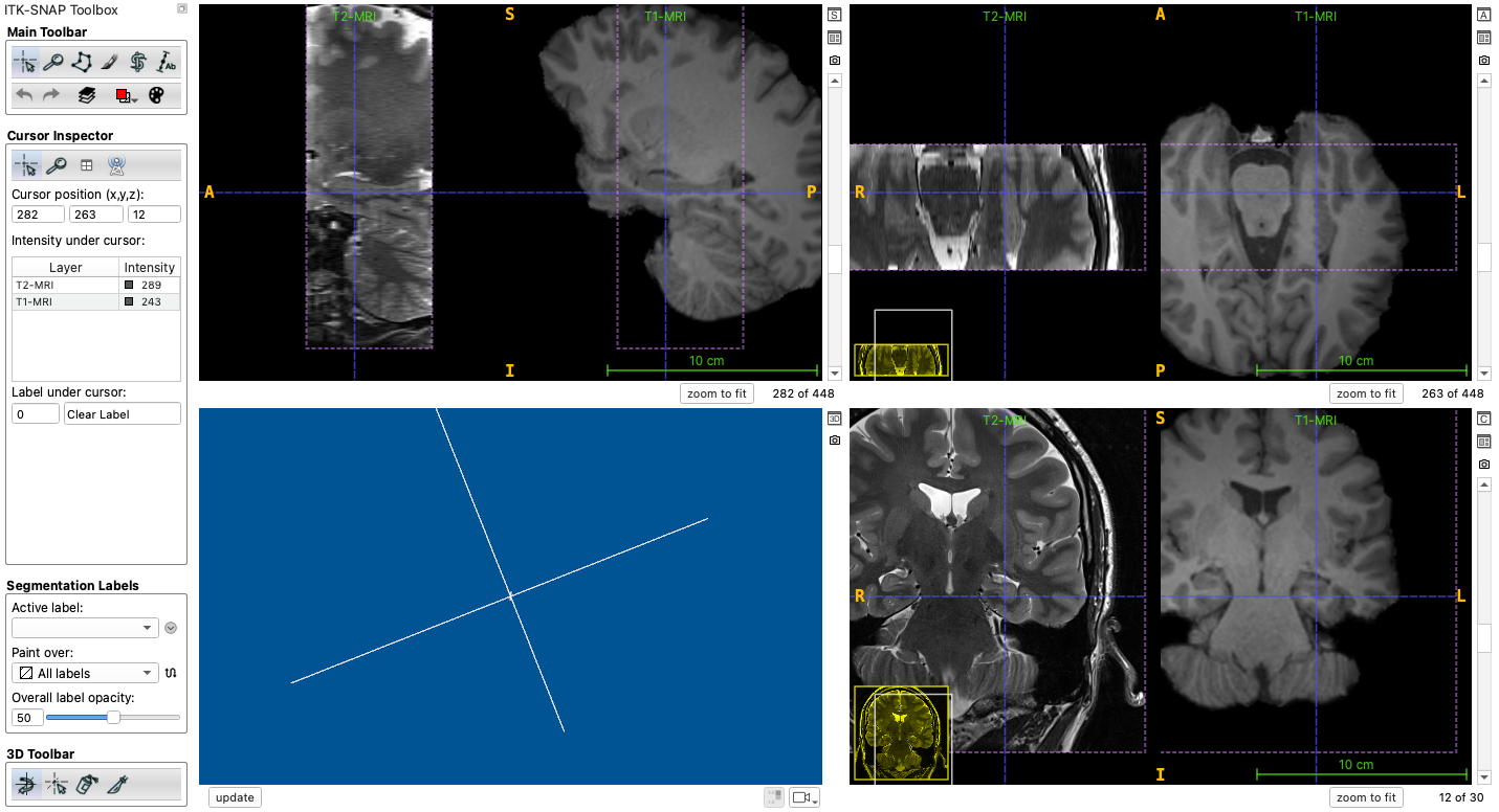 T2w and T1w MRI side by side