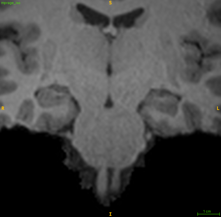 T1-weighted input image